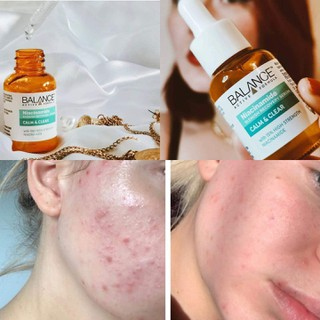 Balance Niacinamide serum سيروم
